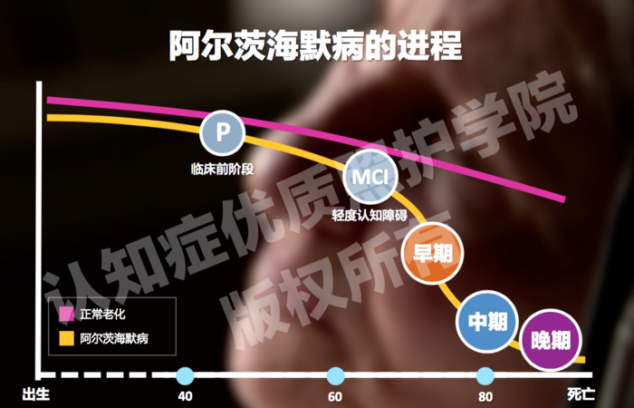 记忆学堂4丨阿尔茨海默病的分期及表现